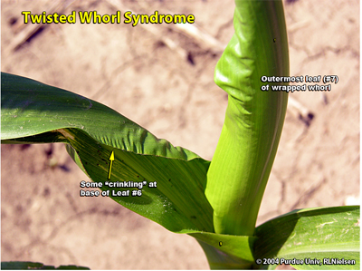 Twisted whorl syndrome