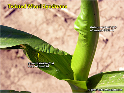 Twisted whorl syndrome