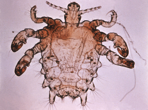 Pubic Louse